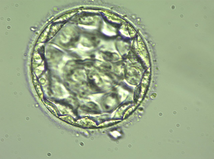 Process of In Vitro Fertilization